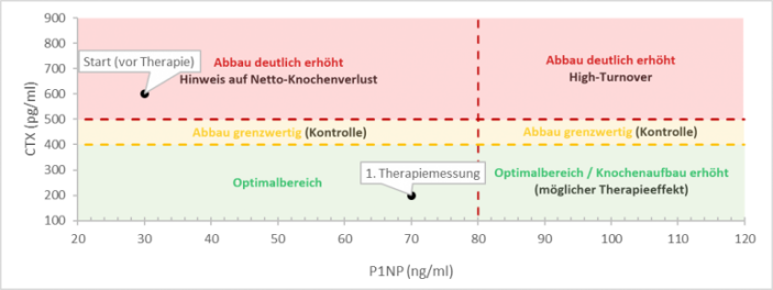 Knochenanalyse: P1NP-Werte zur Bestimmung des Knochenverlusts und Therapieüberwachung Grafik zur Knochenanalyse mit P1NP-Werten und Kennzeichnung von Optimalbereich, Grenzwert und erhöhtem Knochenverlust