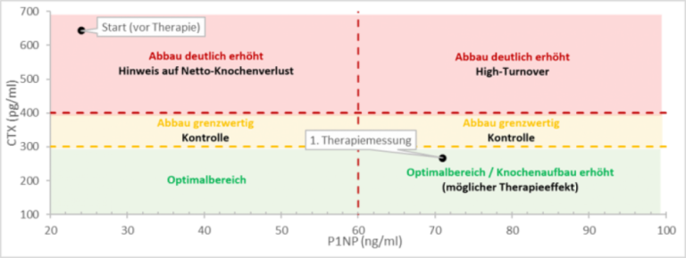 Knochenstoffwechsel: P1NP-Werte und optimaler Bereich zur Überwachung des Knochenabbaus Grafik zum Knochenstoffwechsel mit P1NP-Werten und optimalem Bereich zur Therapiekontrolle
