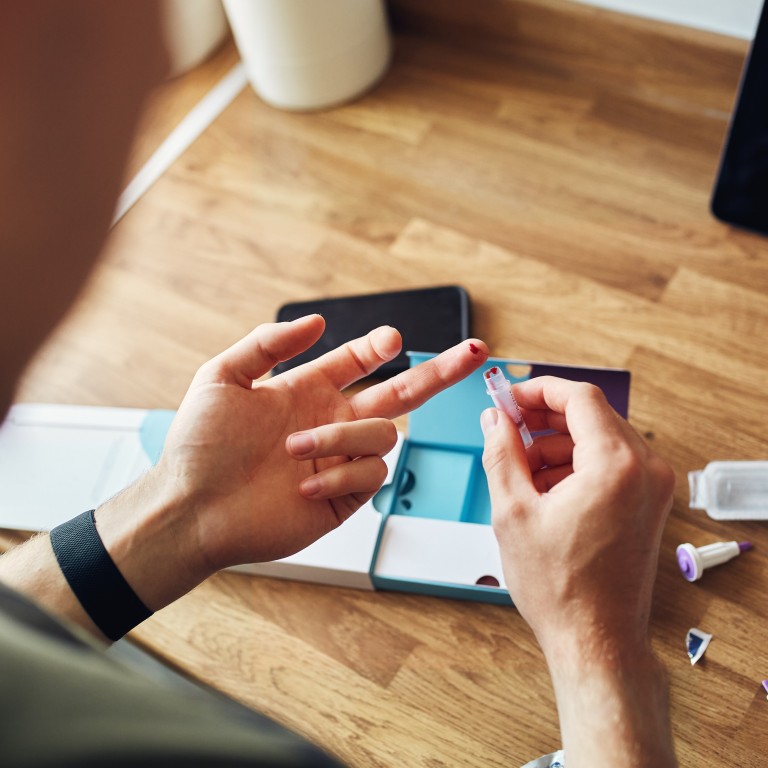 Bluttest zu Hause mit Testkit – Nahaufnahme der Anwendung Person macht einen Bluttest zu Hause mit einem Testkit, Nahaufnahme der Hände mit Blutstropfen am Finger