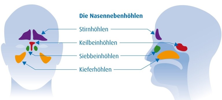 Die Nasennebenhöhlen – Übersicht und Beschriftung der Stirnhöhlen, Keilbeinhöhlen, Siebbeinhöhlen und Kieferhöhlen Grafik der Nasennebenhöhlen mit Beschriftung von Stirnhöhlen, Keilbeinhöhlen, Siebbeinhöhlen und Kieferhöhlen